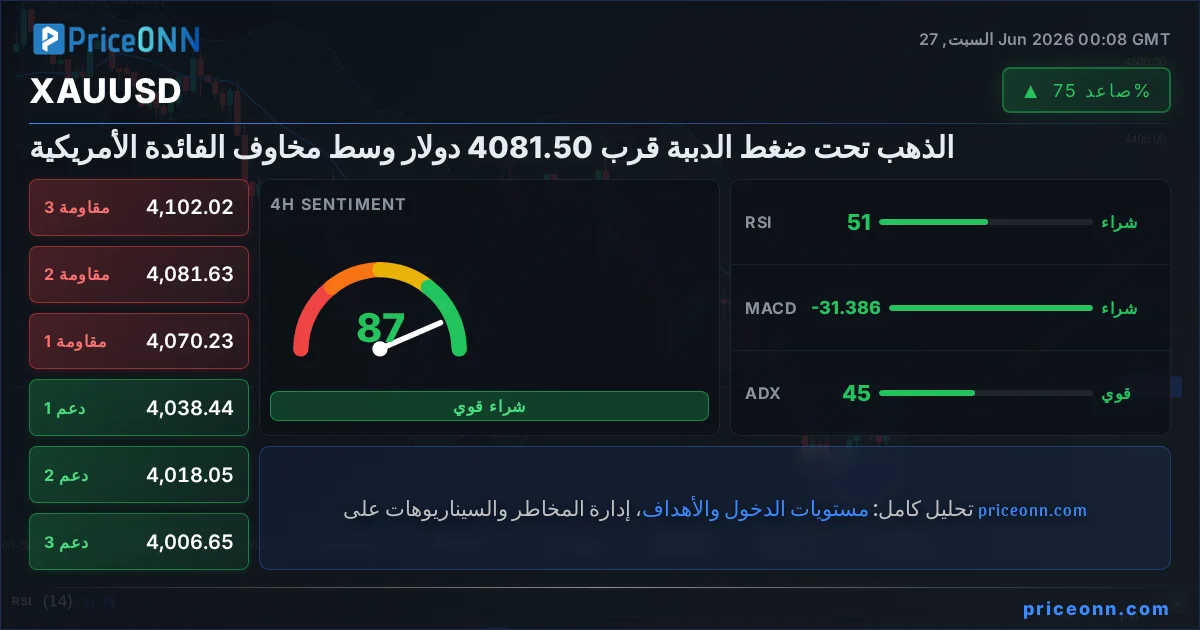 XAUUSD Insight Card